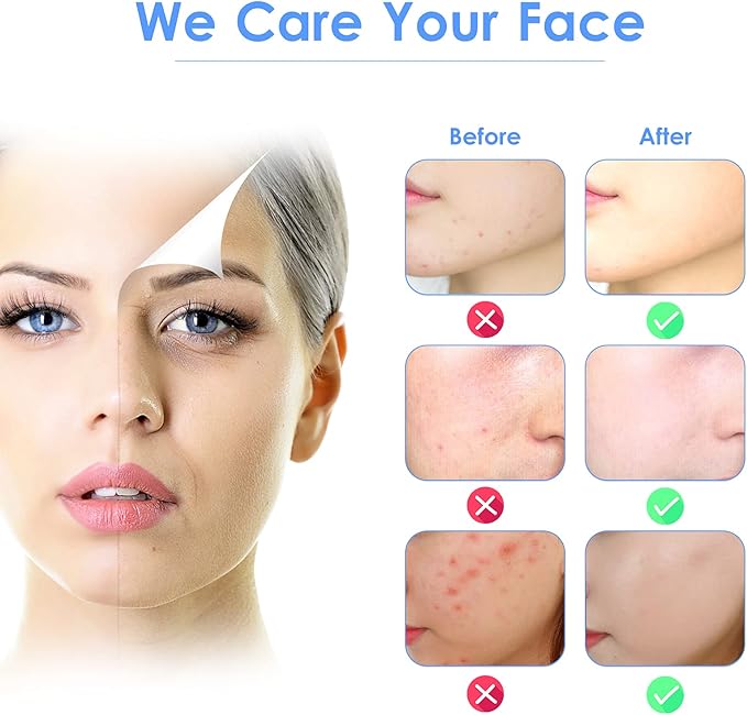3-in-1 Ultrasonic Facial Skin Scrubber – Deep Cleansing, Lifting & Hydrating Tool for Glowing Skin skinity.online